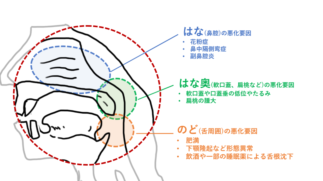 睡眠時無呼吸症候群について | RESM｜新横浜・大森の睡眠呼吸障害治療