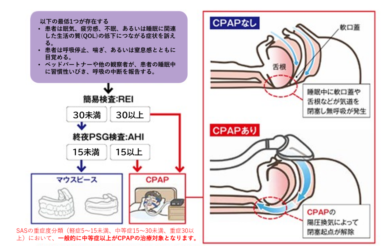 睡眠時無呼吸症候群について | RESM｜新横浜・大森の睡眠呼吸障害治療